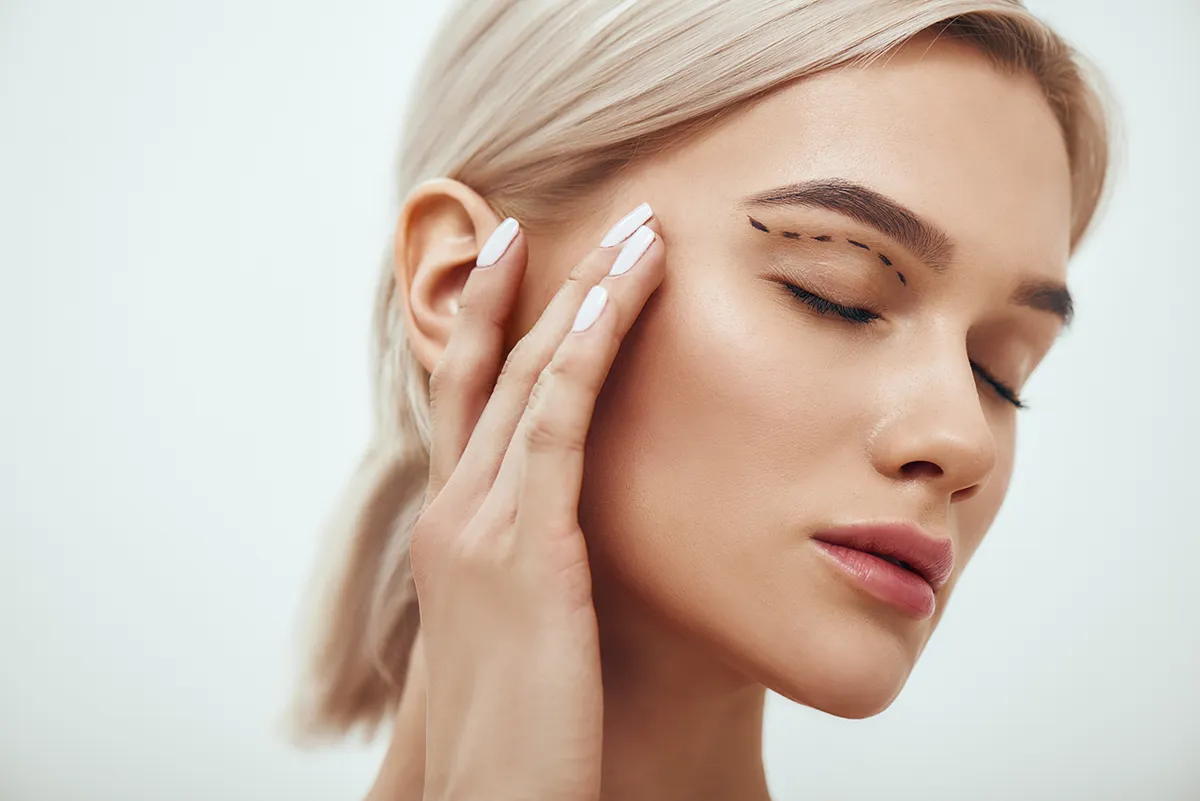 Blépharoplastie