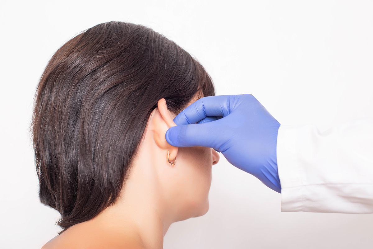 otoplastie