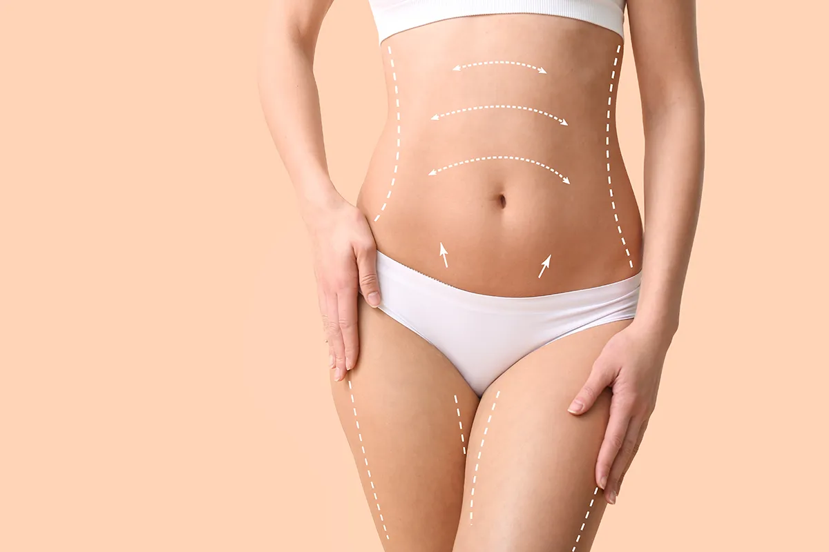 corps abdominoplastie