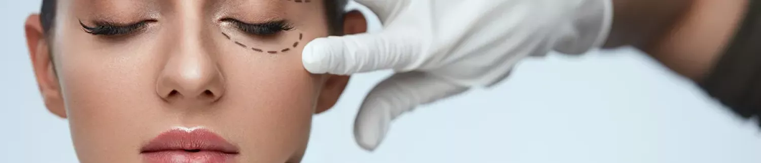 Blépharoplastie